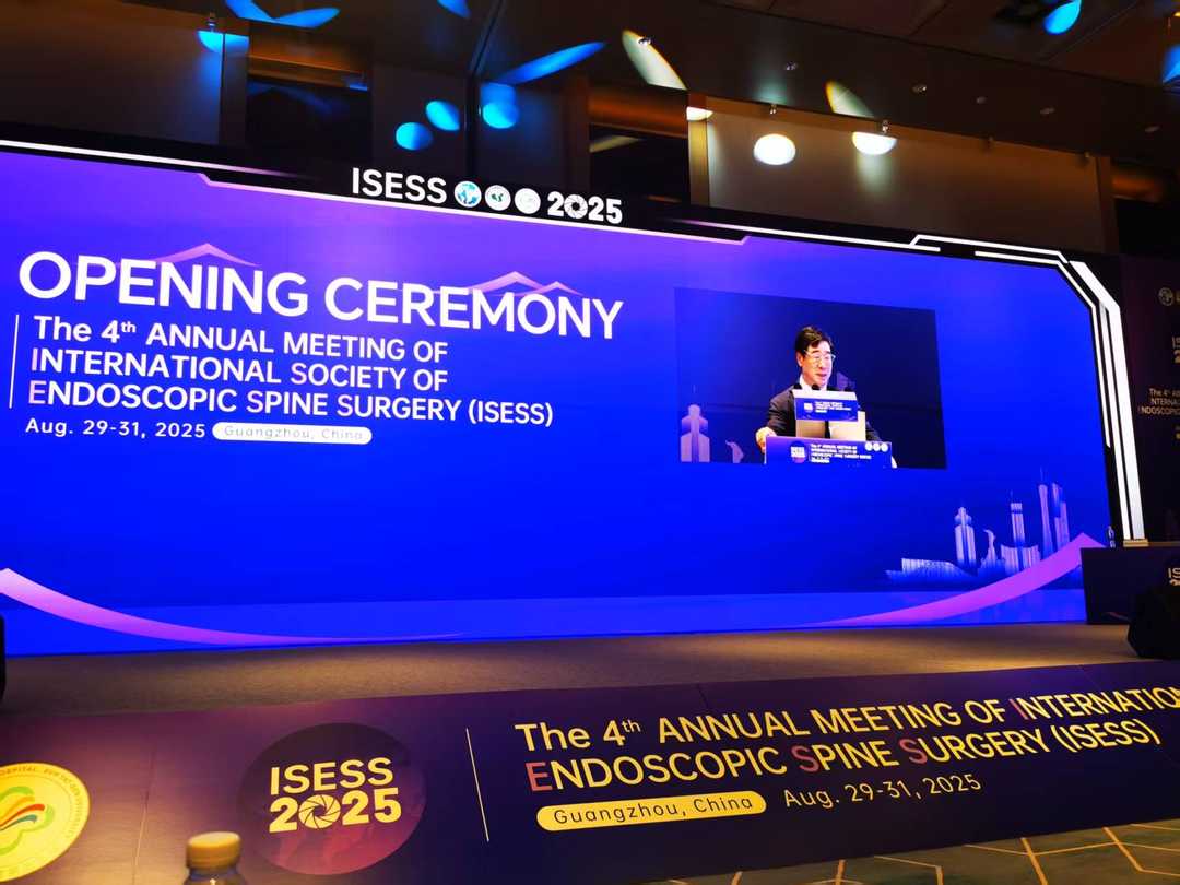Dr. Kaixuan Liu presenting at ISESS 2025 in Guangzhou, China, showcasing transforaminal endoscopic decompression techniques.